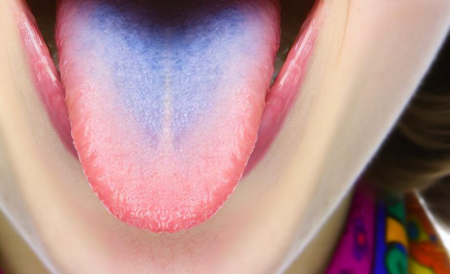 Blauzungen-Bewegung: Lizenz-Guide & Hinweise